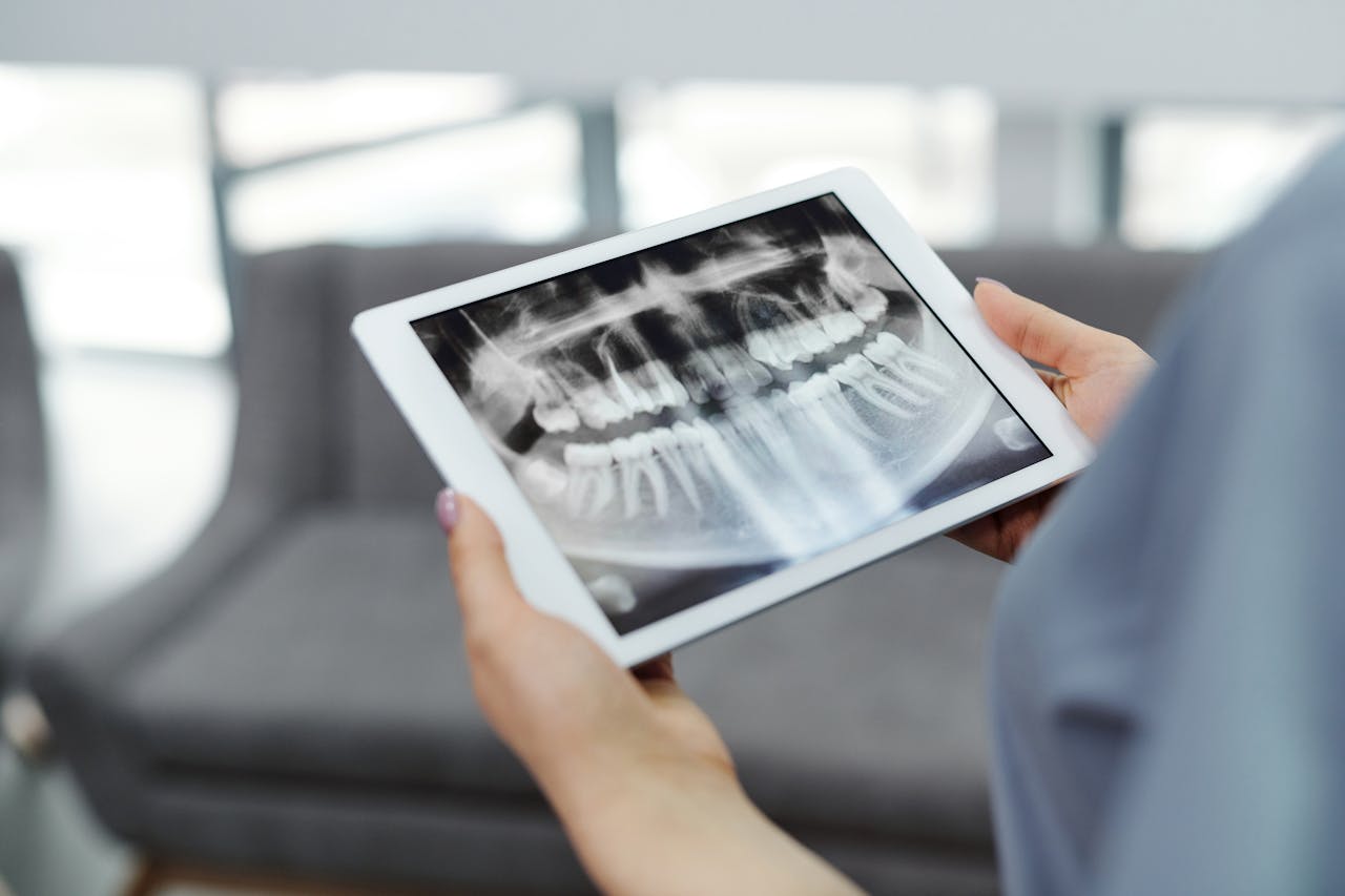 our-services-3 Close-up of hands holding a tablet displaying a dental X-ray indoors.