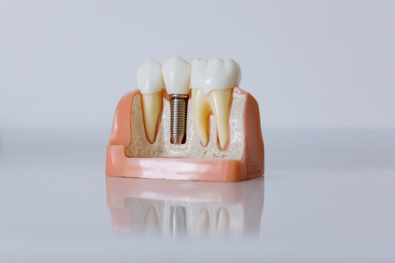 hero-img-02 Detailed dental implant model showcasing teeth structure for educational purposes.