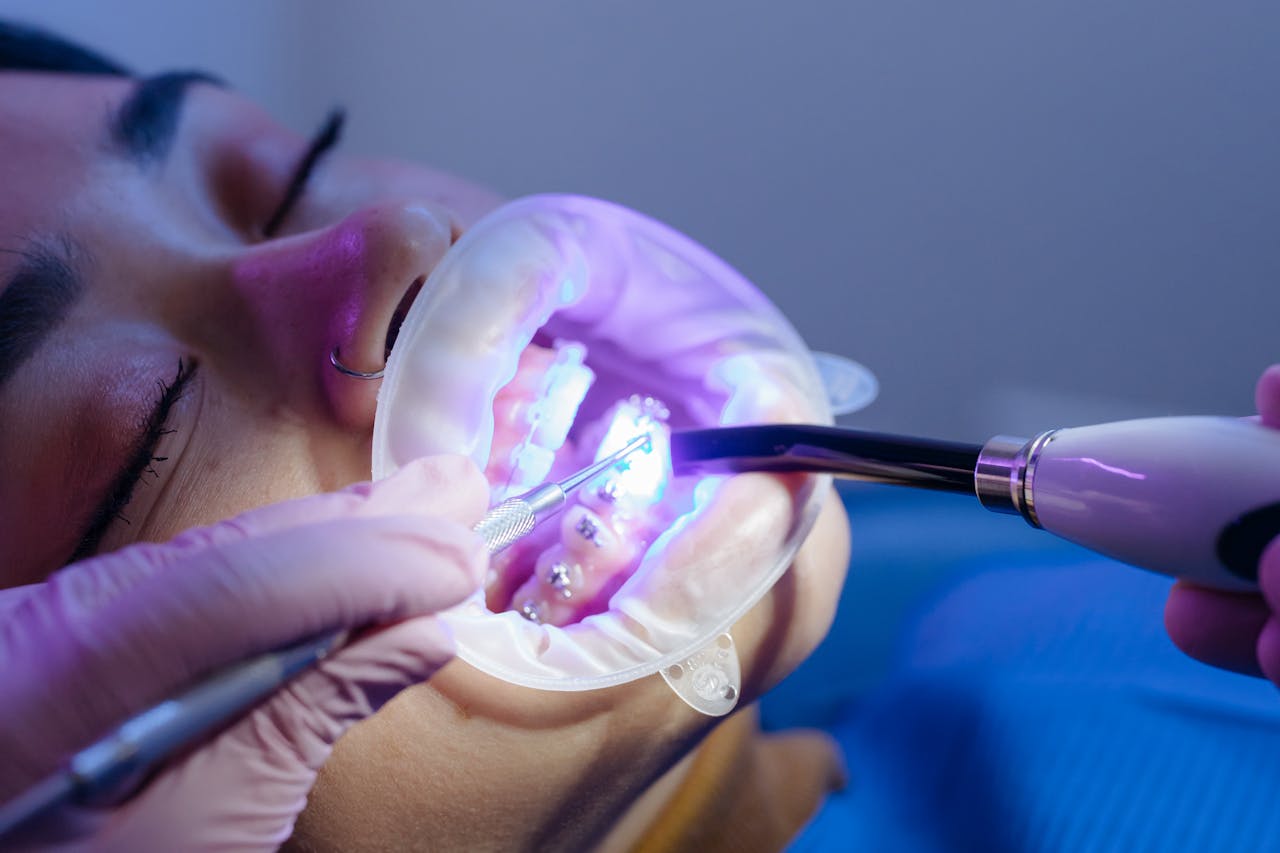 our-services-1 Close-up of a dental procedure using LED light curing for treatment.